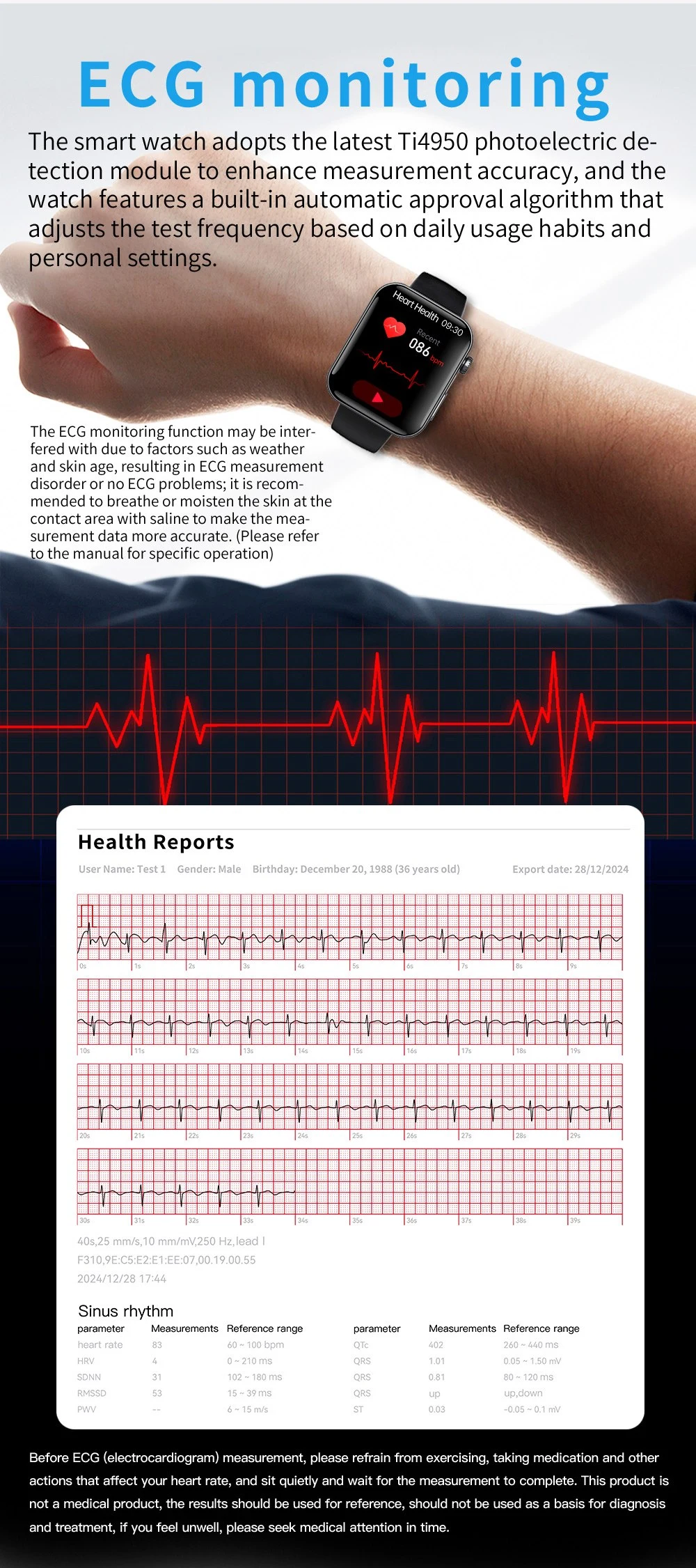 ECG Sport Watch function